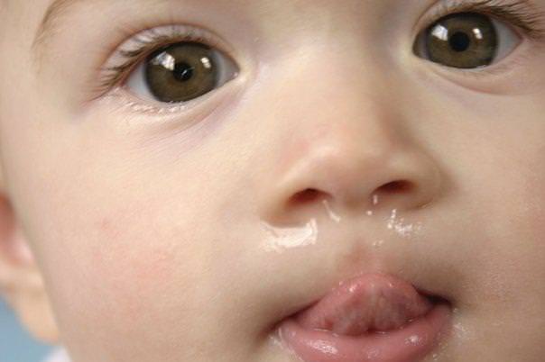 here-s-how-to-stop-a-runny-nose-best-practice-runny-nose-treatment