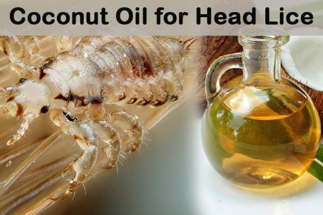 Home Remedies for Lice Treatment