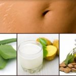 HOME REMEDIES FOR STRETCH MARKS