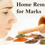 Home Remedies for Acne Marks