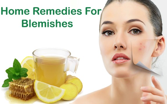Home Remedies for Blemishes