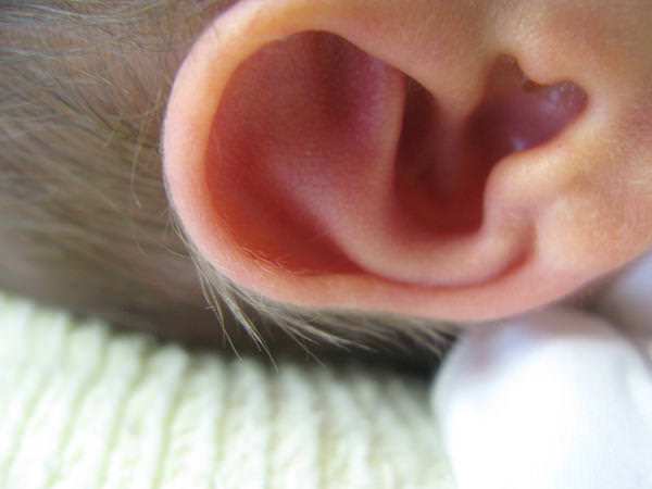 Home remedies for ear discharge