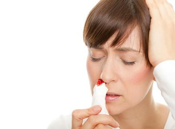 Home remedies for nosebleeds