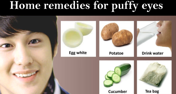 Home remedies for puffy eyes