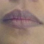 How to Get Rid of Black Lips fast and naturally