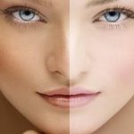 How-to-Lighten-Skin-Naturally