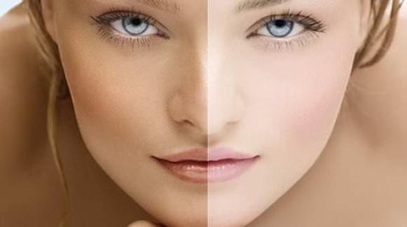 How to Lighten Skin Naturally and Permanently