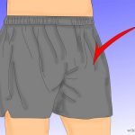 How to get rid of jock itch