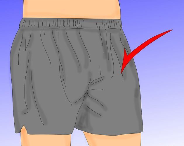 How to get rid of jock itch fast