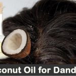 Home Remedies For Dandruff Treatment