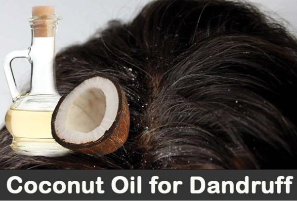 Home Remedies For Dandruff Treatment