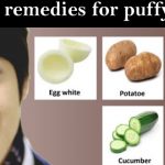 Home remedies for puffy eyes