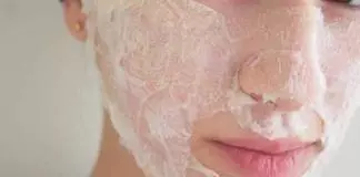 home remedies for blackhead removal