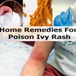 home remedies for cockroaches