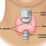 home remedies for hypothyroidism