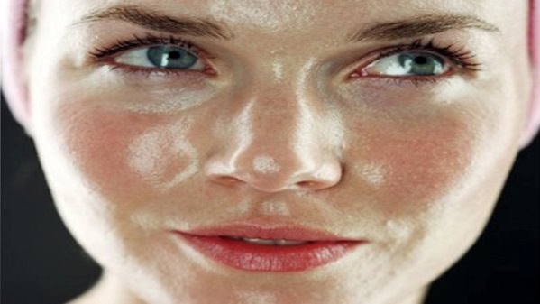 home remedies for oily skin treatment