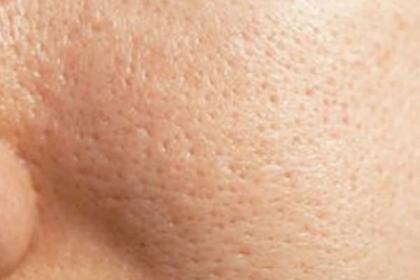 how to minimize pores make pores smaller