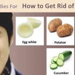 home remedies for puffy eyes_mini