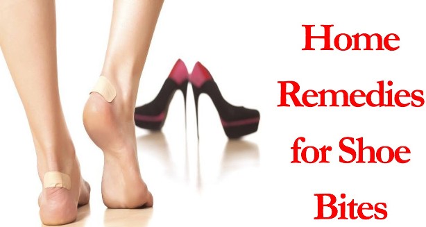 home remedies for shoe bites treatment