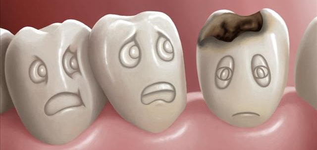 home remedies for tooth decay and cavities