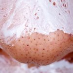 how to get rid of blackheads fast and naturally