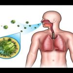 how to get rid of pneumonia at home