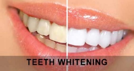 how to get rid of yellow teeth