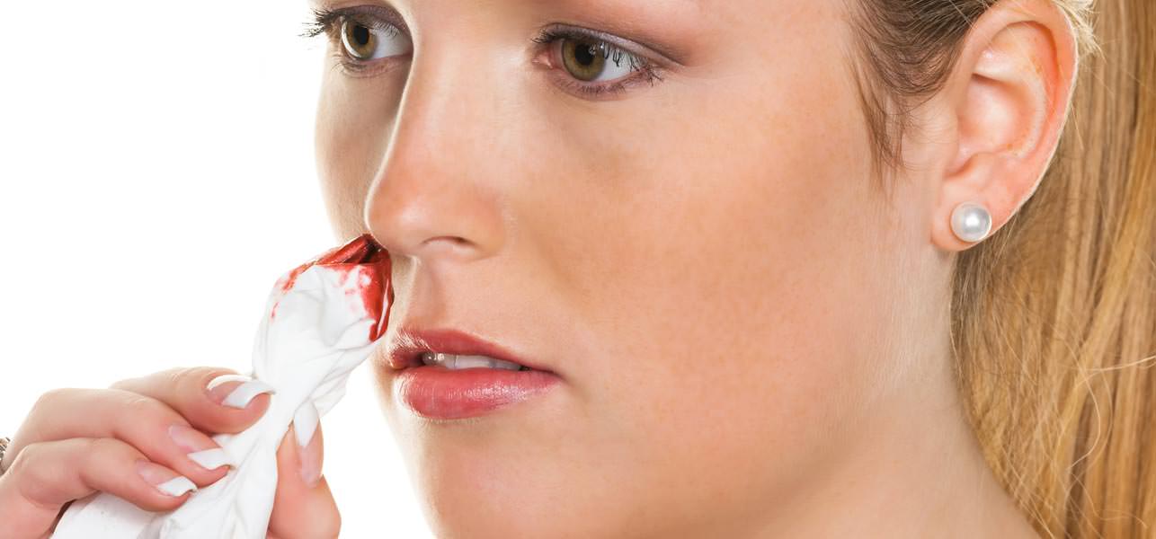 how to stop nose bleeding