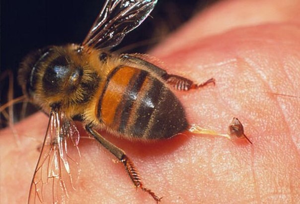 how to treat a bee sting