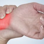 Home Remdies for Arthritis in Hand