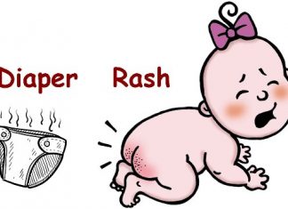 Home Remedies for Diaper Rash