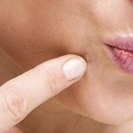 Home Remedies for Facial Warts