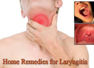 Home Remedies for Laryngitis