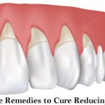 Home Remedies to Cure Reducing Gums