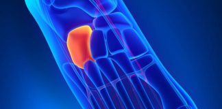 Home remedies for bone spur