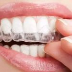 Home remedies for sensitive teeth