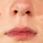 How to Get Rid of Large Pores