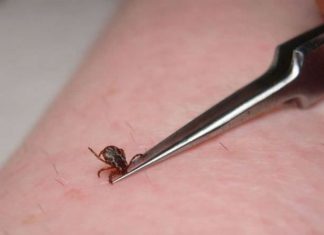How to Remove a Tick