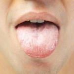 how to get rid of white tongue