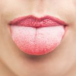 home remedies to treat furry tongue