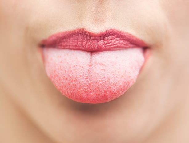 how to get rid of furry tongue or hair tongue treatment