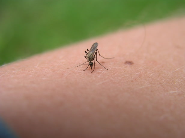 how to stop mosquito bites from itching