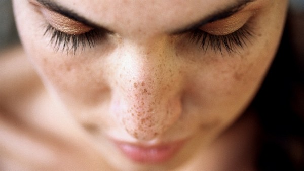 How to get rid of spots quickly