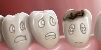 How to treat cavities