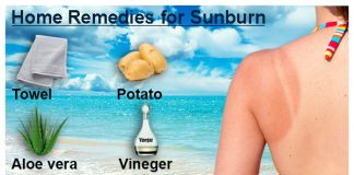 how to get rid of sunburn 1