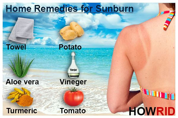 How to Get Rid of Sunburn Fast?