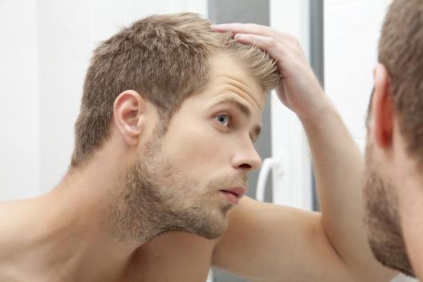 What Is DHT Hair Loss And How To Treat It