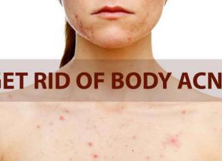 how to get rid of body acne