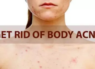 How to Get Rid of Body Acne? how to get rid of body acne