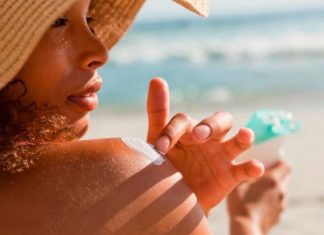 how to get rid of itchy sunburn